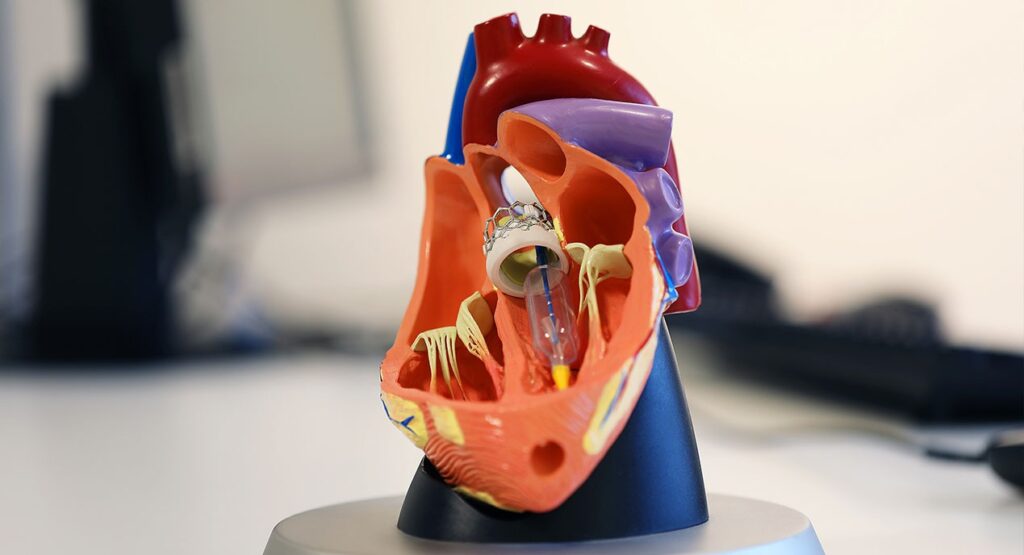 Modellschnitt eines Herzens